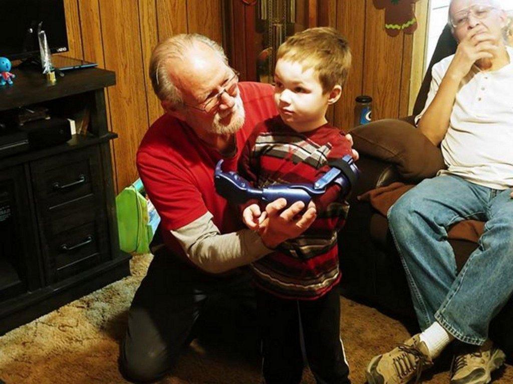 Local Man Creates Prosthetic Arm for Youngster Robert Noyes - ETV News